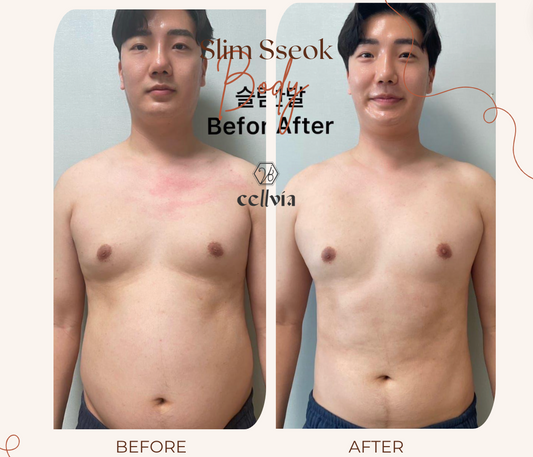 Slim Sseok Testimonial